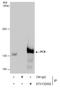 PCB antibody, GTX132002, GeneTex, Immunoprecipitation image 
