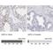 Outer Dense Fiber Of Sperm Tails 2 antibody, NBP1-85417, Novus Biologicals, Immunohistochemistry paraffin image 