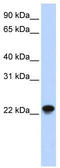 ADP-ribosylation factor-like protein 10B antibody, TA340309, Origene, Western Blot image 