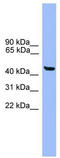 General Transcription Factor IIA Subunit 1 Like antibody, TA335367, Origene, Western Blot image 