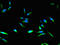 Cyclin-dependent kinase 4 inhibitor B antibody, orb23122, Biorbyt, Immunofluorescence image 