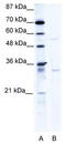 Tripartite Motif Containing 17 antibody, TA336057, Origene, Western Blot image 