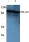 Nuclear factor NF-kappa-B p100 subunit antibody, AP06241PU-N, Origene, Western Blot image 