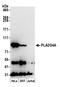 Cytosolic phospholipase A2 antibody, A305-205A, Bethyl Labs, Western Blot image 