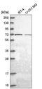 Golgi Associated, Gamma Adaptin Ear Containing, ARF Binding Protein 2 antibody, HPA043313, Atlas Antibodies, Western Blot image 