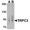 Transient Receptor Potential Cation Channel Subfamily C Member 3 antibody, TA349194, Origene, Western Blot image 