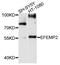 EGF Containing Fibulin Extracellular Matrix Protein 2 antibody, abx135936, Abbexa, Western Blot image 