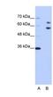 Ro60, Y RNA Binding Protein antibody, NBP1-57301, Novus Biologicals, Western Blot image 