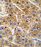 Angiotensinogen antibody, LS-C97169, Lifespan Biosciences, Immunohistochemistry paraffin image 