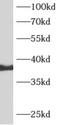 Arfaptin-2 antibody, FNab00540, FineTest, Western Blot image 