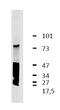 Leucine Rich Repeat Containing 32 antibody, AM26772PU-N, Origene, Western Blot image 