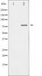 Forkhead Box O1 antibody, TA325476, Origene, Western Blot image 