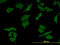 Dihydropyrimidine dehydrogenase [NADP+] antibody, LS-C197076, Lifespan Biosciences, Immunofluorescence image 