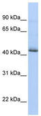 Serum Response Factor Binding Protein 1 antibody, TA339806, Origene, Western Blot image 