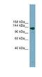 ASXL Transcriptional Regulator 2 antibody, NBP1-56576, Novus Biologicals, Western Blot image 