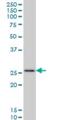 Homeobox C12 antibody, H00003228-M07, Novus Biologicals, Western Blot image 