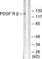Platelet Derived Growth Factor Receptor Beta antibody, TA312018, Origene, Western Blot image 