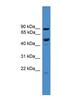 Mab-21 Domain Containing 2 antibody, NBP1-79527, Novus Biologicals, Western Blot image 