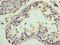 Inter-Alpha-Trypsin Inhibitor Heavy Chain 4 antibody, LS-C369857, Lifespan Biosciences, Immunohistochemistry paraffin image 