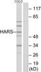 Histidyl-TRNA Synthetase antibody, LS-B9136, Lifespan Biosciences, Western Blot image 