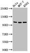 Ellis-van Creveld syndrome protein antibody, CSB-PA007862LA01HU, Cusabio, Western Blot image 