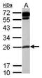 COMM Domain Containing 10 antibody, PA5-31868, Invitrogen Antibodies, Western Blot image 