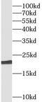 BH3-interacting domain death agonist antibody, FNab00893, FineTest, Western Blot image 