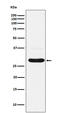 Charged Multivesicular Body Protein 2B antibody, M01935, Boster Biological Technology, Western Blot image 