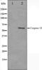 Matrix Metallopeptidase 16 antibody, orb224408, Biorbyt, Western Blot image 