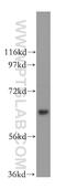 Alpha-globin transcription factor CP2 antibody, 15203-1-AP, Proteintech Group, Western Blot image 