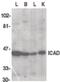 DNA Fragmentation Factor Subunit Alpha antibody, PA5-19890, Invitrogen Antibodies, Western Blot image 
