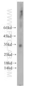 AlkB Homolog 1, Histone H2A Dioxygenase antibody, 13234-1-AP, Proteintech Group, Western Blot image 