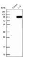 Complement C1s antibody, NBP1-86439, Novus Biologicals, Western Blot image 