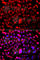 Tumor Protein P53 Binding Protein 2 antibody, A5704, ABclonal Technology, Immunofluorescence image 