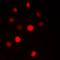 Pre-mRNA branch site protein p14 antibody, orb215185, Biorbyt, Immunofluorescence image 