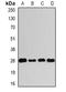 VENT Homeobox antibody, orb341307, Biorbyt, Western Blot image 
