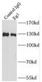 Kinesin-like protein KIF11 antibody, FNab02665, FineTest, Immunoprecipitation image 