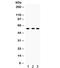 Cytochrome P450 Family 27 Subfamily B Member 1 antibody, R31812, NSJ Bioreagents, Western Blot image 
