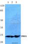 Apolipoprotein B MRNA Editing Enzyme Catalytic Subunit 3A antibody, A01183, Boster Biological Technology, Western Blot image 