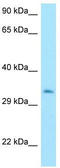 Metaxin 3 antibody, TA338341, Origene, Western Blot image 
