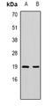 Programmed cell death protein 5 antibody, orb381943, Biorbyt, Western Blot image 