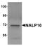 NLR Family Pyrin Domain Containing 10 antibody, A08124, Boster Biological Technology, Western Blot image 