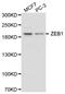 Zinc Finger E-Box Binding Homeobox 1 antibody, TA332404, Origene, Western Blot image 