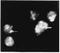 Nucleolin antibody, GTX16940, GeneTex, Immunocytochemistry image 
