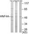 Hepatocyte Nuclear Factor 4 Alpha antibody, EKC1720, Boster Biological Technology, Western Blot image 