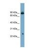 Solute Carrier Family 6 Member 5 antibody, NBP1-59657, Novus Biologicals, Western Blot image 