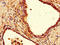 Coatomer Protein Complex Subunit Epsilon antibody, LS-C394481, Lifespan Biosciences, Immunohistochemistry paraffin image 