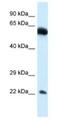 Nicolin 1 antibody, NBP1-79827, Novus Biologicals, Western Blot image 