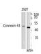 Doublecortin antibody, STJ92771, St John