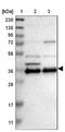 Chondroadherin antibody, NBP1-87031, Novus Biologicals, Western Blot image 